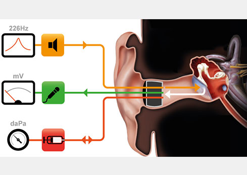 Audiometry and impedance